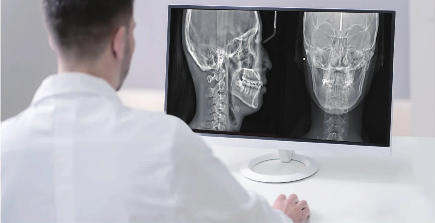 Profesional revisando imágenes cefalométricas lateral y frontal