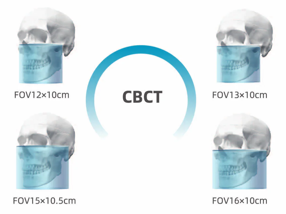Configuraciones de FOV del CBCT Meyer 3D Pro: 12×10, 13×10, 15×10,5 y 16×10 cm