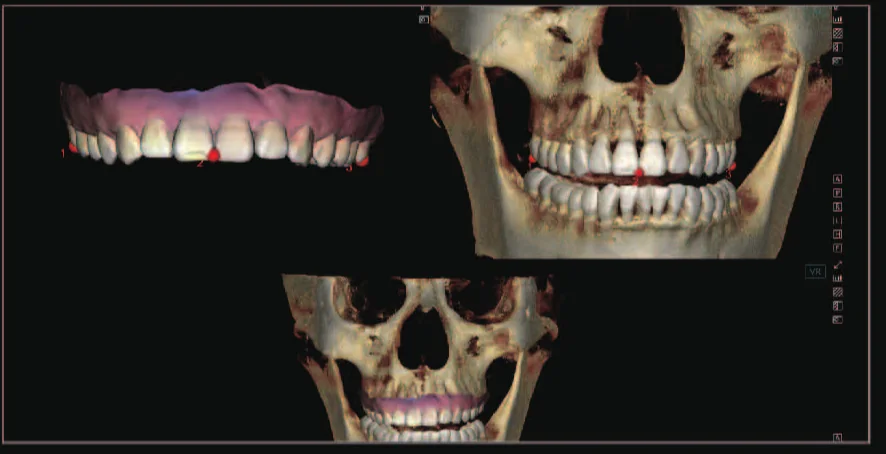 Registro tridimensional de cara y mandíbula